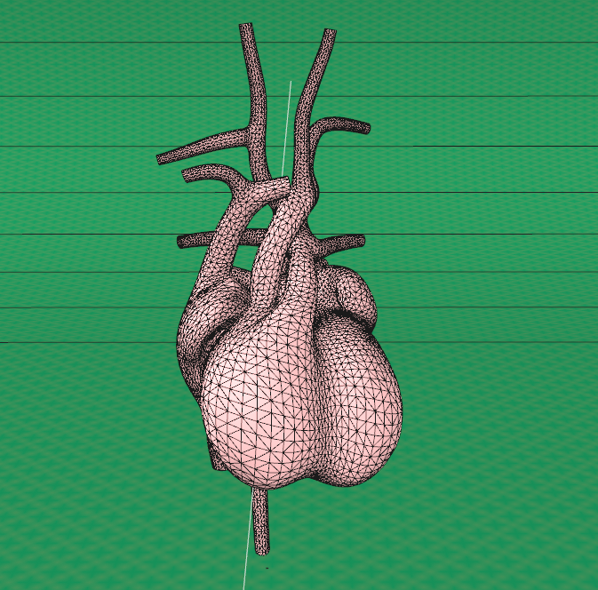 胚胎主动脉-肺动脉间隔 3D模型 Embryonic Aorticopulmonary Septum 3D Model 01 - 医学插画师-动画师-阿杜的原创生物医学可视化社团作品